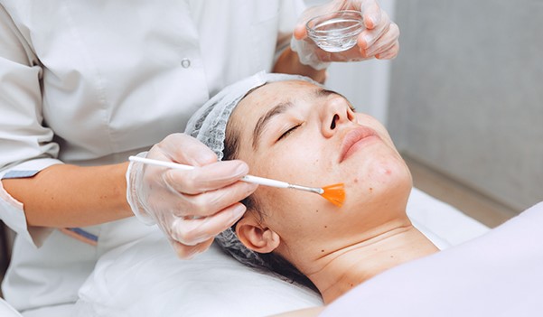 Chemical Peels Chemical Peels