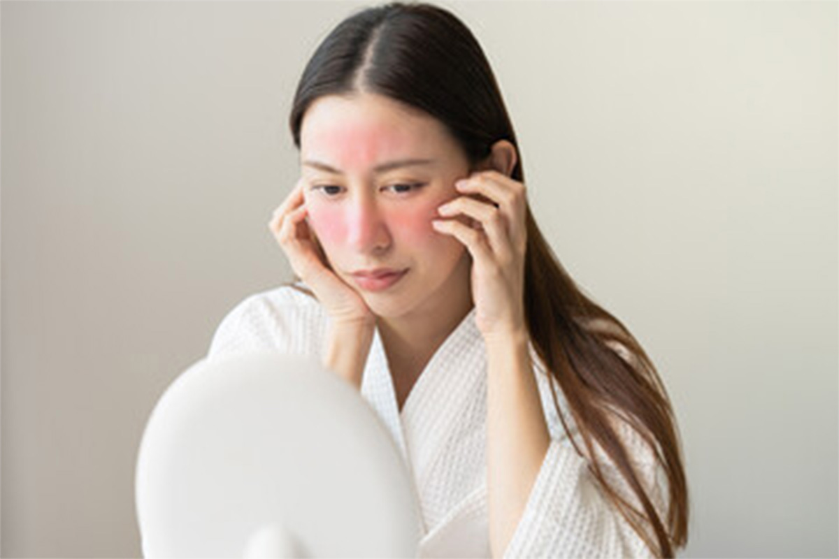 Reduce dilated blood vessel