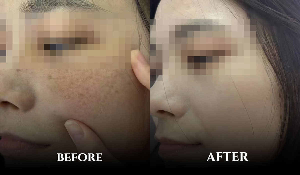 before&after2