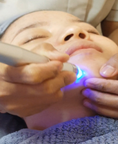 Dead Skin Removal